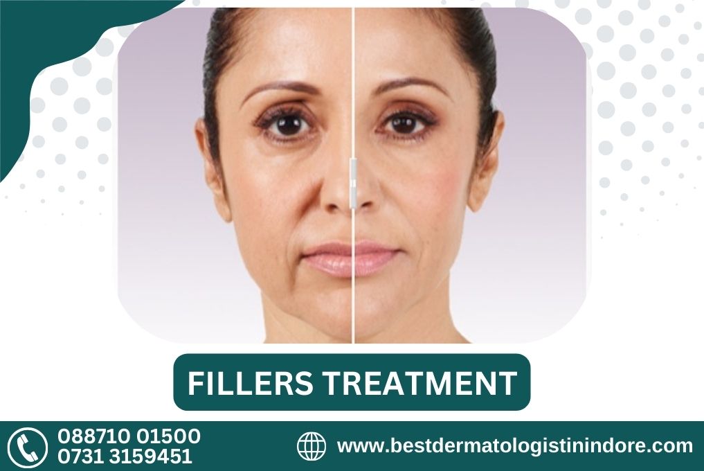 Best Skin Specialist for Fillers Treatment in Indore